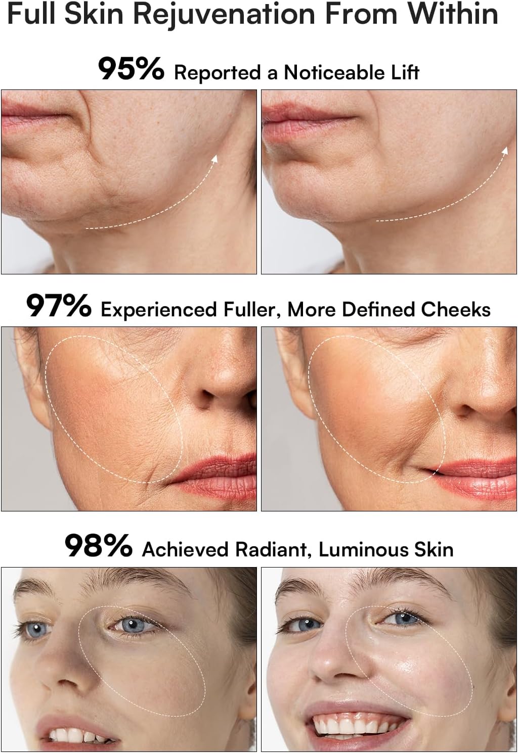 INIA 3-in-1 Red Light Therapy for Face and Neck Beauty Device for Puffiness & Skin Firming Skincare Tool (White)